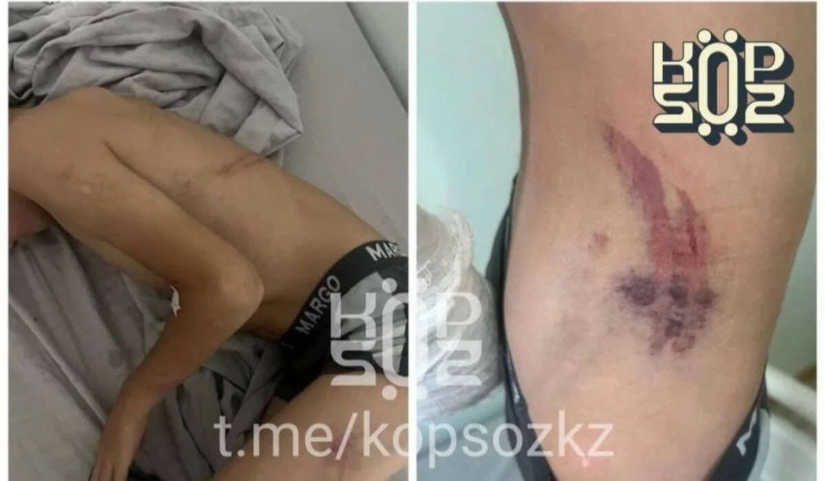 Женщина обвинила сотрудника «Казахмыса» в жестоком избиении 8-летнего сына