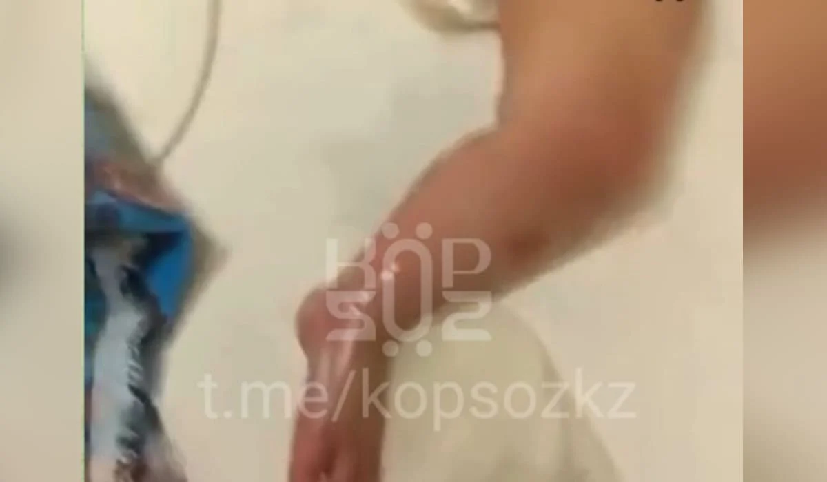 Скандал в больнице Астаны: младенец получил ожог во время лечения (ВИДЕО)