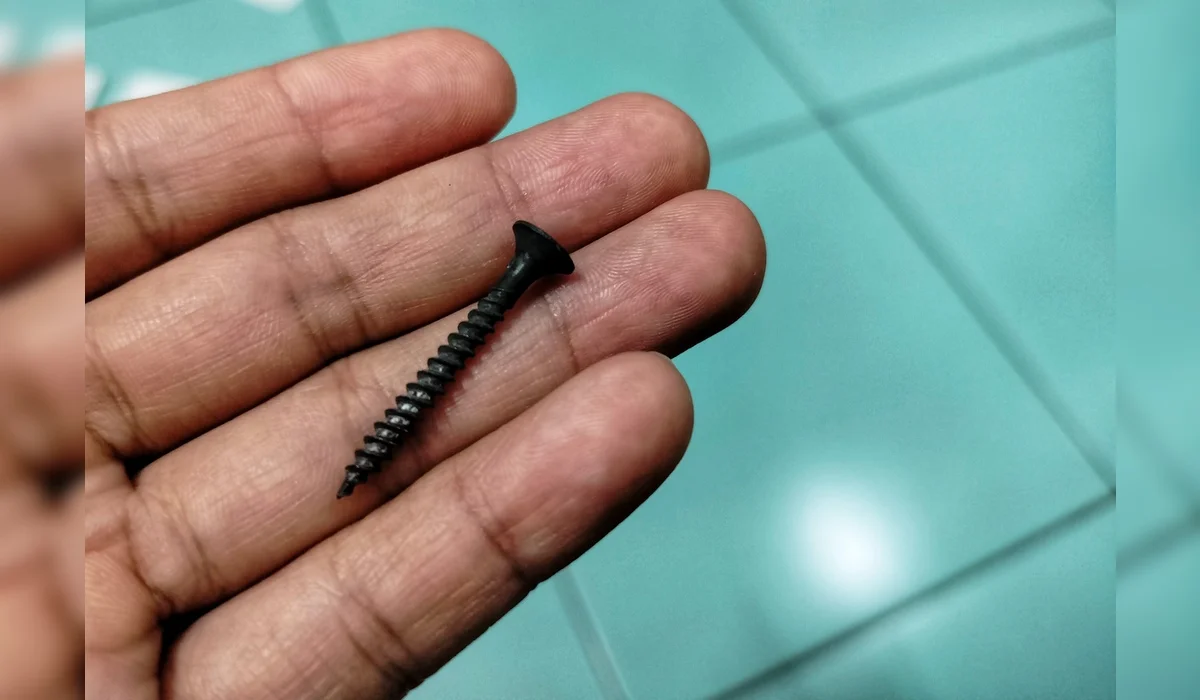 Мужчина из-за стресса проглотил гвозди в Узбекистане