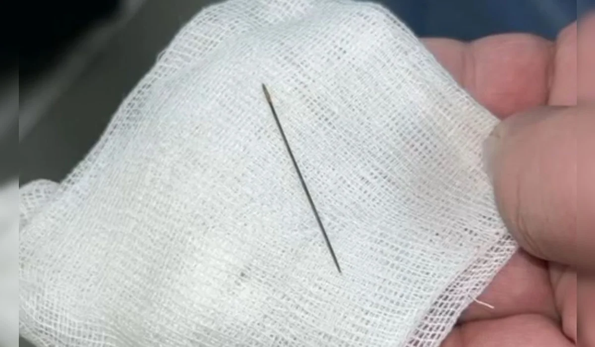 Иглу нашли в брюшной полости 8-месячного ребенка в Туркестане (ВИДЕО)