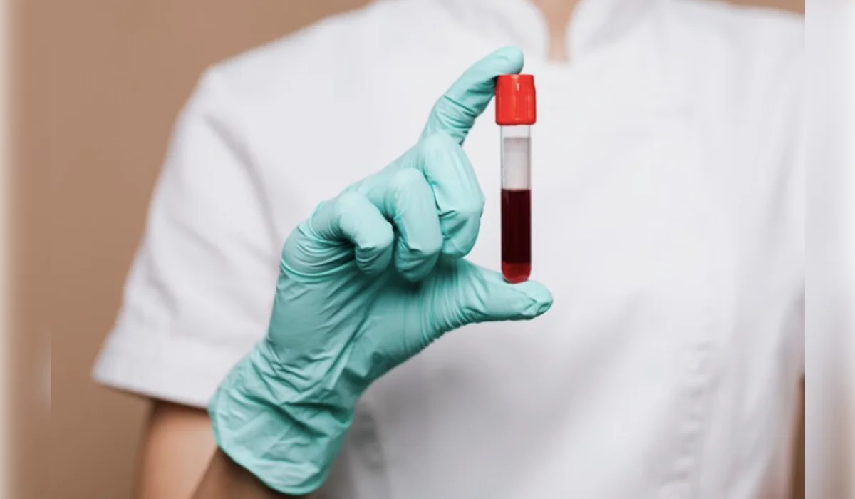 80 тысяч пациентов ежегодно получают донорскую кровь в Казахстане