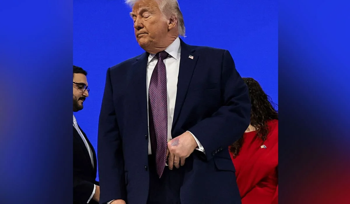 Белый дом прокомментировал пятно на руке Дональда Трампа