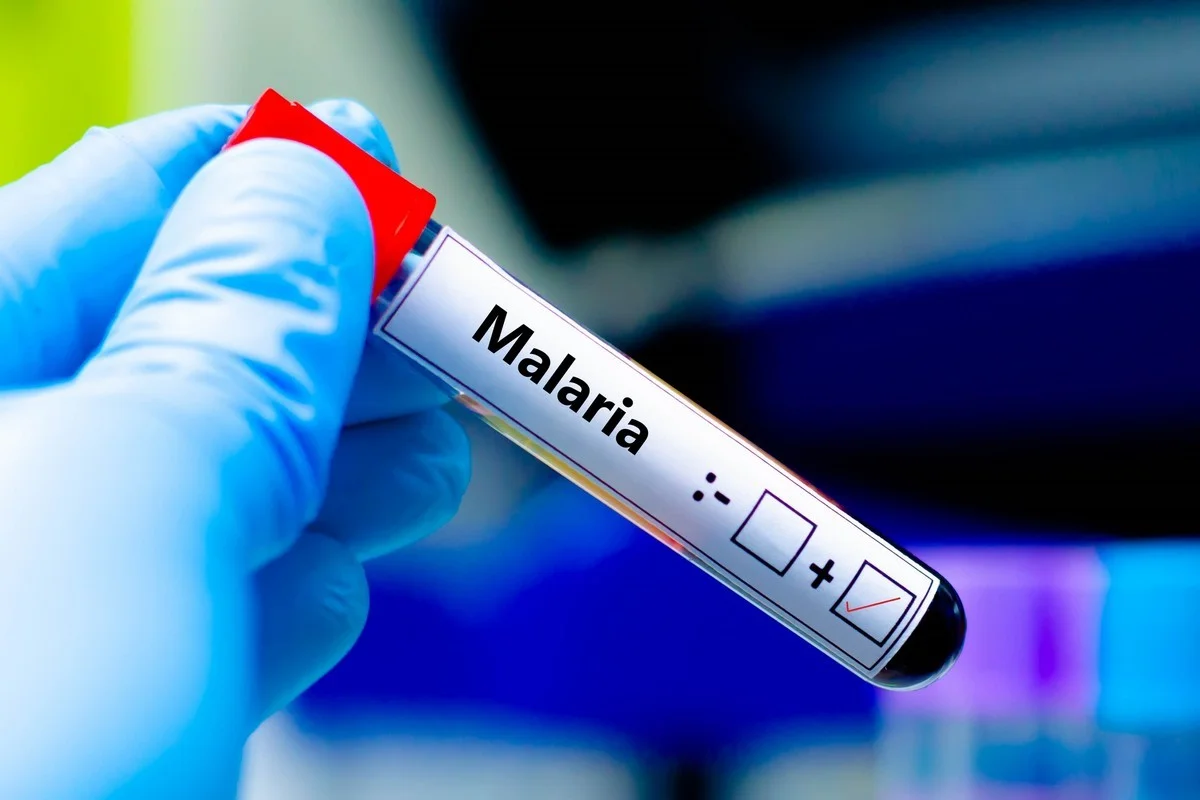 Опасную малярию выявили у вернувшейся из Африки казахстанки