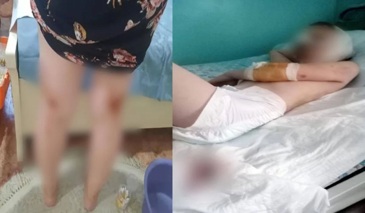 Тысячи пострадавших и искалеченные дети: почему поправки к закону о животных неизбежны в Казахстане