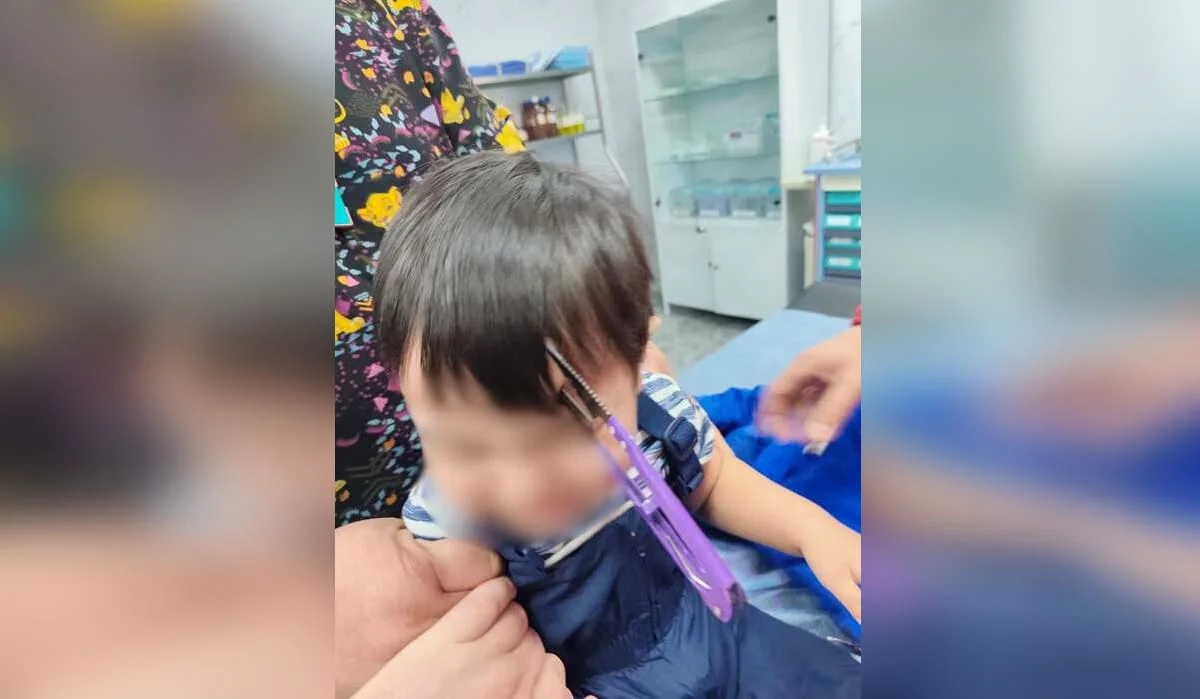 Малыш упал на ножницы в Алматы – они застряли в голове: чем все закончилось