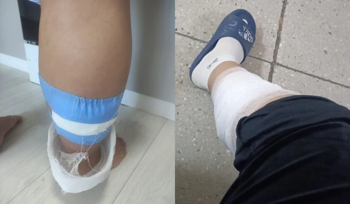 Стая бродячих собак напала на беременную женщину и искусала ее в Кокшетау