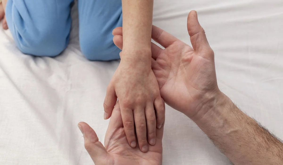 Заболеваемость корью в Казахстане снизилась на 30% за неделю – Минздрав