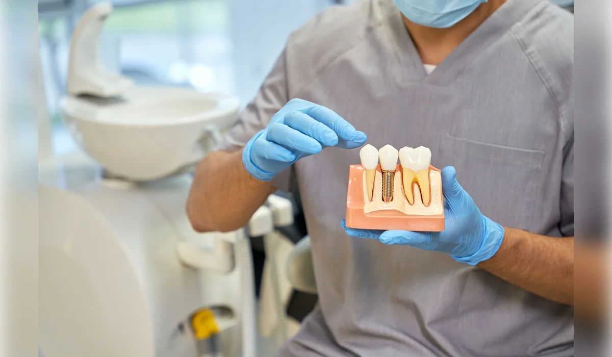 Кариес, импланты, протезы: на сколько подорожало лечение зубов в Казахстане