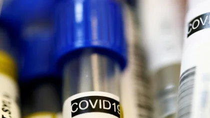 Число зараженных COVID-19 казахстанцев достигло 1 546