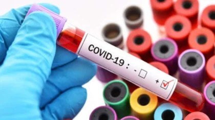 1 630 случаев заражения COVID-19 выявлены в Казахстане