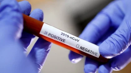 Число зараженных COVID-19 казахстанцев возросло до 2 950