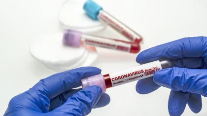 До 5 240 увеличилось число зараженных коронавирусом в Казахстане