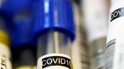 5 417 достигло число случаев заражения COVID-19 в Казахстане