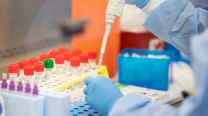 Национальный центр экспертизы приостановил платное ПЦР-тестирование