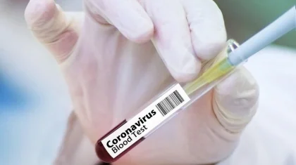До 16 639 увеличилось число бессимптомных носителей COVID-19 в РК
