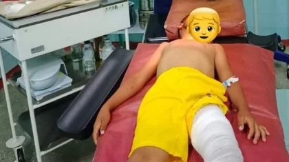 Собака разодрала лицо 7-летнему мальчику в Жамбылской области