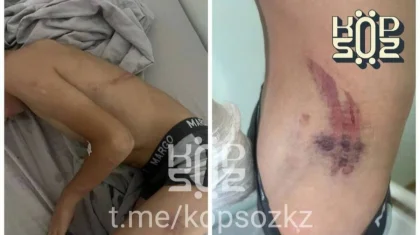 Женщина обвинила сотрудника «Казахмыса» в жестоком избиении 8-летнего сына
