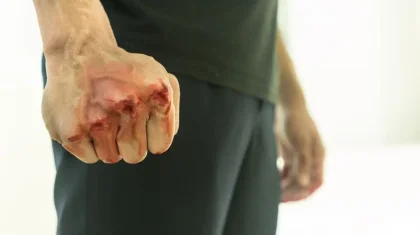 «Они были вооружены»: сторожа приюта избили в Алматинской области (ВИДЕО)