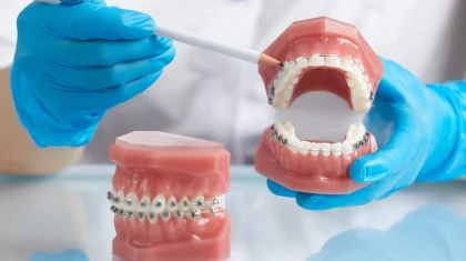 Детям будут бесплатно давать брекеты? Что говорят в Фонде соцмедстрахования