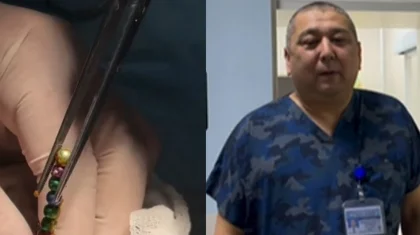 Проглотившего 16 магнитов трехлетнего мальчика спасли хирурги в Шымкенте (ВИДЕО)