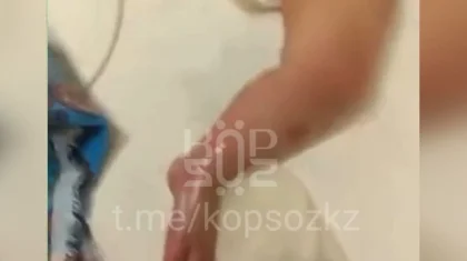 Скандал в больнице Астаны: младенец получил ожог во время лечения (ВИДЕО)