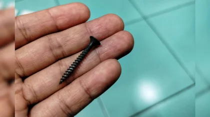 Мужчина из-за стресса проглотил гвозди в Узбекистане