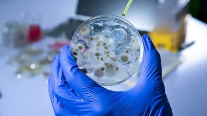 В Актюбинской области взяли почти тысячу проб почвы на сибирскую язву: что показали результаты