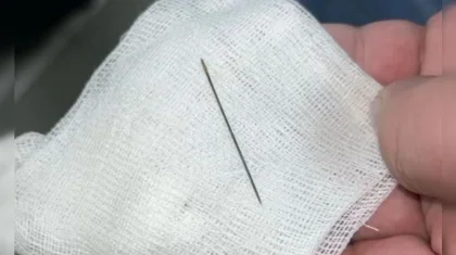 Иглу нашли в брюшной полости 8-месячного ребенка в Туркестане (ВИДЕО)