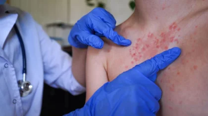 Корь у детей в Казахстане: санврачи обратились к родителям