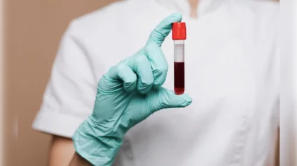 80 тысяч пациентов ежегодно получают донорскую кровь в Казахстане