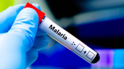 Опасную малярию выявили у вернувшейся из Африки казахстанки
