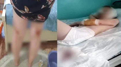 Тысячи пострадавших и искалеченные дети: почему поправки к закону о животных неизбежны в Казахстане