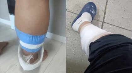 Стая бродячих собак напала на беременную женщину и искусала ее в Кокшетау