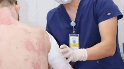 Врачи спасли пациента с ожогами 90% тела после взрыва газового баллона в Алматы