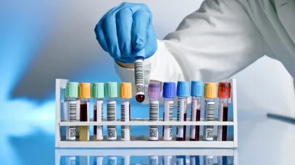 Оспу обезьян подтвердили у пяти пациентов в России