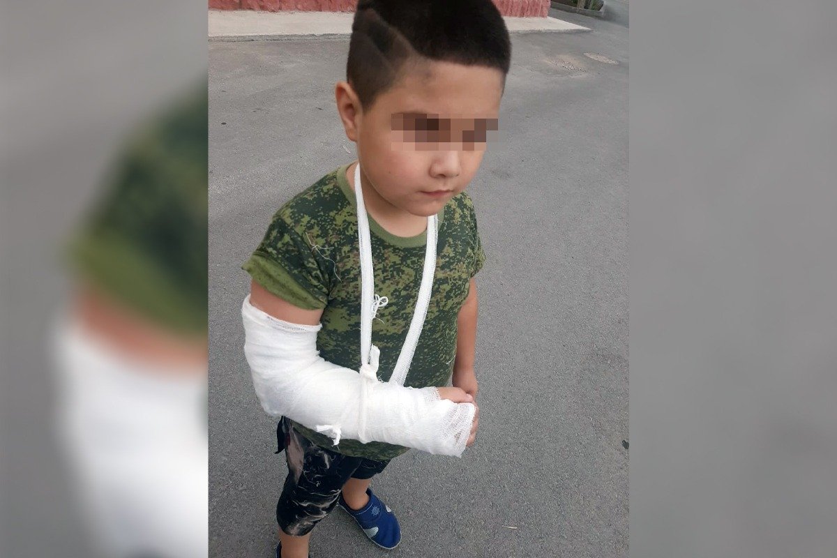 Мальчик получил сотрясение мозга и перелом в детском саду в Алматинской области 